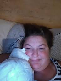 Farting in sleep causes nose burns during lunch break