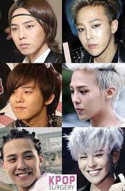 Are Idols Getting Too Many Chin Fillers Kpopandkimchi Kpop Vingle Interest Network