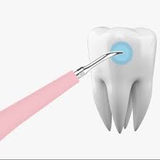 Dental Calculus Plaque Remover Tool Dental Kit Perfect For Keeping Teeth Sparkling Clean Stained Teeth Dental Plaque Removal