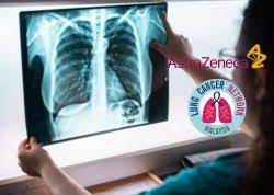 Check spelling or type a new query. Ai X Ray Enables Early Detection Of Lung Cancer