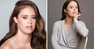 Champion Gymnast With Down Syndrome Becomes A Model, Paving The Way For  Others Like Her : The Hearty Soul