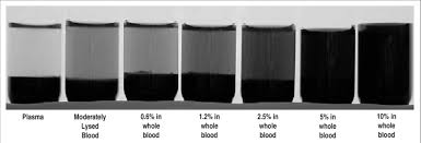 Color Chart For Plasma Lysed Sample And Samples Spiked With