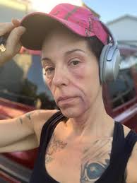 I have lupus and all mask breaking out my face! I am forced to wear while  working! What to do? Having autoimmune disorder already I have issues. I  work part time to