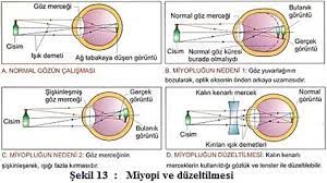 Biyolojidersim Goz Bozukluklari