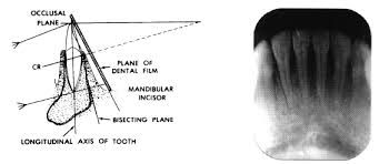 Dental Radiography