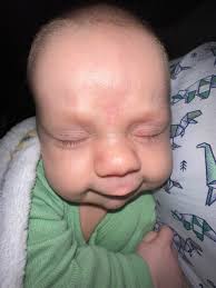 How to relieve congestion in babies?