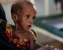 Médecins Sans Frontières opens Papua New Guinea clinic for abuse victims