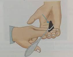 Image result for Supinator Reflex
