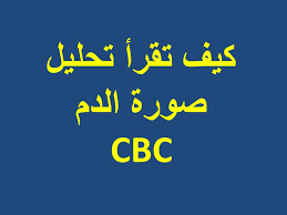 مختبرات الصياء للتحاليل الطبية كيف نفسر نتائج تحليل Cbc ناخذ محاضرة جميلة جدا في صياغة سيناريوا درامي جميل نستخلص منه كيغ نفسر نتائج Cbc محاضرة اليوم قصة القرد و الموزة