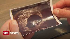 Ssw ❤ alle infos zu anzeichen, symptome, entwicklung beim ultraschall in der 7. Nach Schwangerschaftsabbruch Swica Bittet Schwangere Mit Todkrankem Ungeborenen Zur Kasse News Srf