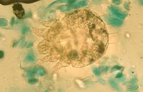 Image result for Sarcoptes scabiei life cycle