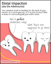Impacted wisdom teeth that cause pain or other dental complications are usually removed. Wisdom Teeth Personalities