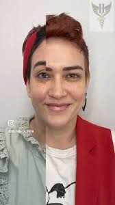 Otra hermosa paciente feliz 😍 y rejuvenecida 🤩 después de pasar por  #hosannamedspa La prevención es la clave del éxito. No esperes a que esas  líneas de expresión se profundicen y sea