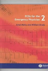 Ecgs For The Emergency Physician 2 Medicine Book Emergency Medicine Emergency