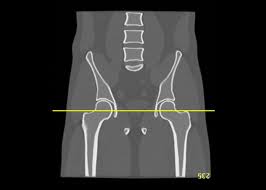 Pelvic xray anatomy to download pelvic xray anatomy just right click and save image as. Virtual Human Male Pelvis Phantom Cirs