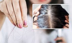 What causes skin and hair issues in women with pcos? Hair Loss Treatment Anti Androgens Ideal For Women With Polycystic Ovaries Express Co Uk