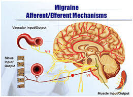 Headaches And Migraines Homeopathic Treatment For Headaches And Migraines Symptoms Causes Types