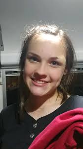 Softball injury requires 7 stitches