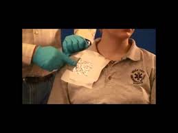 Image result for Occlusive Dressing
