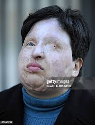 327 Bucket Over His Head Stock Photos, High-Res Pictures, and Images