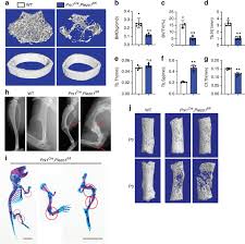 Internal remodeling of bone models describes the process by which bone adapts its histological structure to change the wave propagation modeling in cylindrical human long dry bones with cavity is studied. Mechanical Sensing Protein Piezo1 Regulates Bone Homeostasis Via Osteoblast Osteoclast Crosstalk Nature Communications