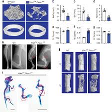 Prenatal, growth during childhood and adolescence, and later in life due to injuries. Mechanical Sensing Protein Piezo1 Regulates Bone Homeostasis Via Osteoblast Osteoclast Crosstalk Nature Communications