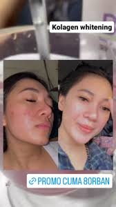 Tenang aja mom Skincare heslin aman kok buat bumil dan busui Yuk tetap  rawat wajahmu, meskipun lagi hamil , biar glowing bersih dan cerah ya❤️  Shopee : viyana27 Wa : 087801001529 #heslinbeauty #