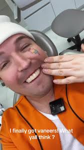 I just got my veneers in Colombia ! Yall feelin them? Im so in love! #fyp  #forupage #williamthebaddest #viral #veneers