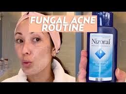 It starts when greasy secretions from the ski. Treat Fungal Acne With This Skincare Routine Skincare Youtube Acne Skincare Routine Skin Care Routine Steps Acne Face Cleanser