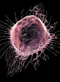 Undergoing a mammogram to detect breast cancer in its early stages is called screening. Breast Cancer Types