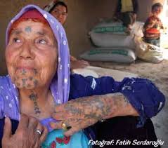 Biride başka bir bölgeye piercing dedi de. Op Dr Oytun Idil Www Kozmetikcerrahi Com
