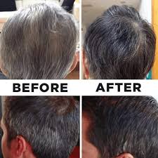 Excessive use may weigh the hair down, but does not stop its growth. Buy 2pcs Hair Darkening Shampoo Reverse Grey Hair Color Shampoo To Prevent White Hair Natural Hair Color Shampoo Help Boost Hair Growth 200ml Online In Turkey B085vx4bd4