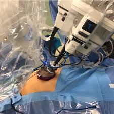The protoypes took his court by storm. Da Vinci Sp Single Robotic Arm With Multiple Instruments Entering Download Scientific Diagram