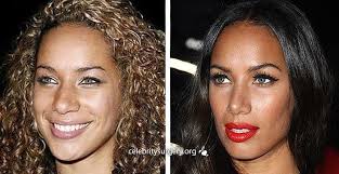 Leona Lewis Rhinoplasty Before And After Plastic Surgery Pictures Nose Job