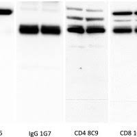 Custom controllers xbox design lab ideas. Western Blot Of Anti Igm Igg Cd4 And Cd8 Antibodies Against Devil Download Scientific Diagram