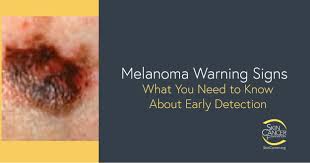 Lipomas have often been there for many years and rarely change in size. Melanoma Warning Signs And Images The Skin Cancer Foundation