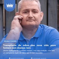 Transplante de mãos deu nova vida para homem com doença rara