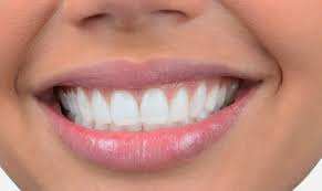 Piranhas have a reputation for being some of the more ferocious fish in the world. Cypress Texas And Healthy Smiles Spring Cypress Dental