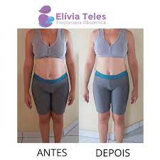 adeus diastase resultado incrivel essa mamae tinha 3 dedos de diastase e com muita determinacao e disciplina faz instagram diastase abdominal dedo