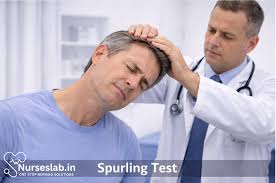 Image result for Spurling Sign