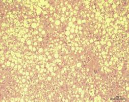 Activation of a Specific Gut Bacteroides-Folate-Liver Axis Benefits for the  Alleviation of Nonalcoholic Hepatic Steatosis