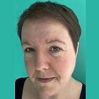 Redpatch by Raes Calvert