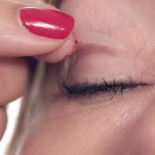 Learn more about the causes, symptoms, treatment, outlook, and prevention of different types of eyelid bumps. Pin On Beauty And Hair