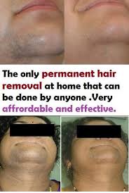 Suspended Medium Hair Removal Permanent Chin Hair Removal Facial Hair Removal
