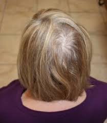 Usually give you way more texture and grit than a spray—two things you very much want if you're trying to amp up fine or thin. 70 Hair Products For Fine Thin Hair Ideas In 2021 Hairstyles For Thin Hair Hair Thin Fine Hair