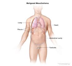 The spleen sits under your rib cage in the upper left part of your abdomen toward your back. Thoracic Oncology Program Malignant Mesothelioma
