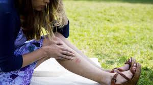 Moustique > soigner ses piqûres > piqure de moustique : Comment Savoir S Il Faut Faire Examiner Une Piqure D Insecte Huffpost Quebec Vivre