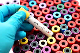 Hiv (human immunodeficiency virus) adalah virus yang merusak sistem kekebalan tubuh, dengan menginfeksi dan menghancurkan sel cd4. Apa Itu Penyakit Hiv Dan Aids Doctoroncall