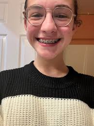 Trust the process #braces #bracesoff #bracesjourney #trusttheprocess #deaf