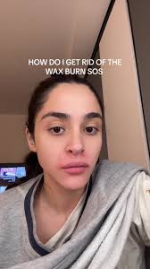 Covering Wax Burn with Foundation